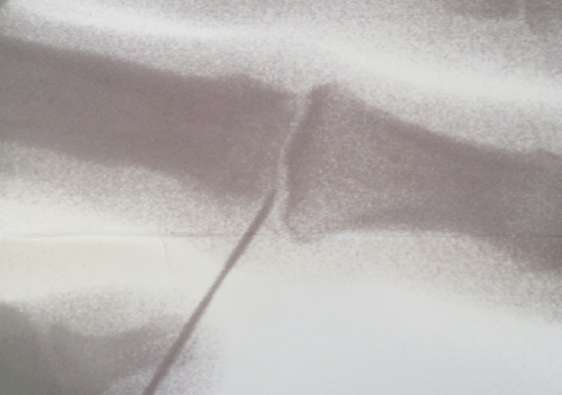 x ray small